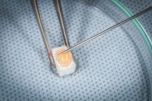 Zebodoly_poekstrakcyjne_ND59697